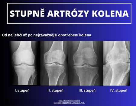 photo-Artóza