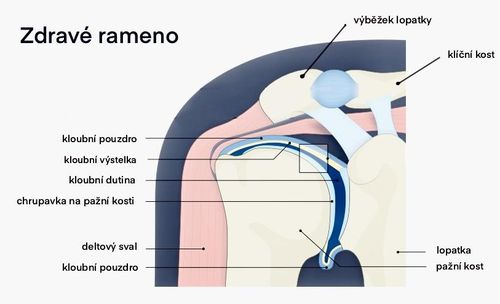 Zdravé rameno